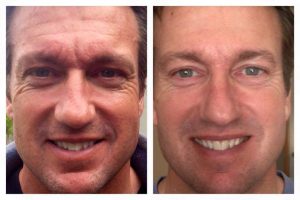 Best Nerium Cream Reviews